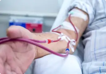 Dialysis AV fistula